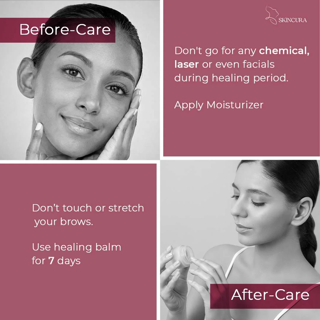 Product photography for Skincura by Social Drishti